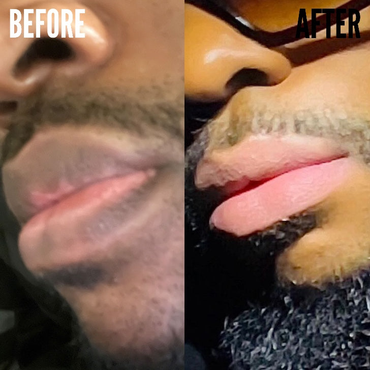 Men’s Lip Lightener for (Dark & Damaged Lips)